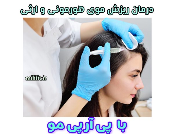 درمان ریزش موی هورمونی و ریزش موی ارثی با پی آر پی