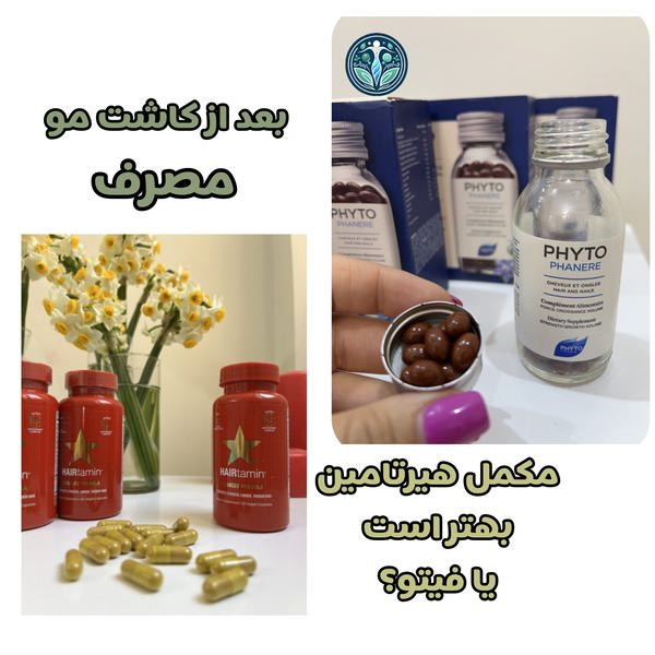 بعد از کاشت مو هیرتامین بهتر است یا فیتو؟
