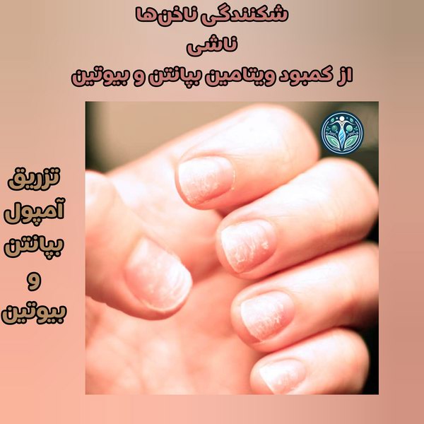 علائم نیاز به آمپول بپانتن و بیوتین