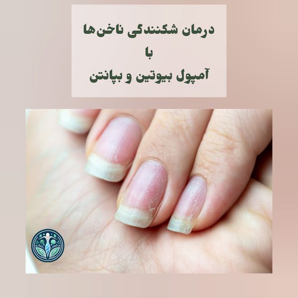 درمان شکنندگی ناخن با آمپول بیوتین و بپانتن
