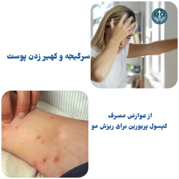 عوارض مصرف پریورین برای ریزش مو