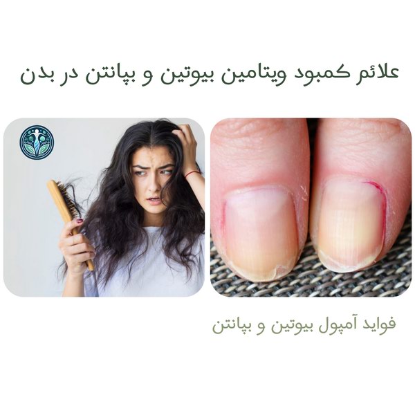 کمبود ویتامین بیوتین و بپانتن
