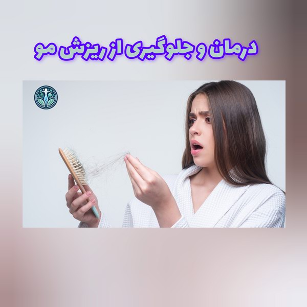 درمان و جلوگیری از ریزش مو