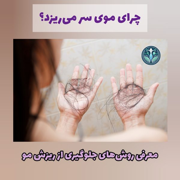 چرا موی سر میریزد